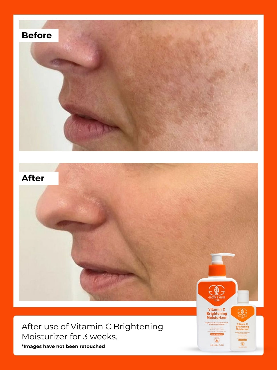 Vitamin C Brightening Moisturizer