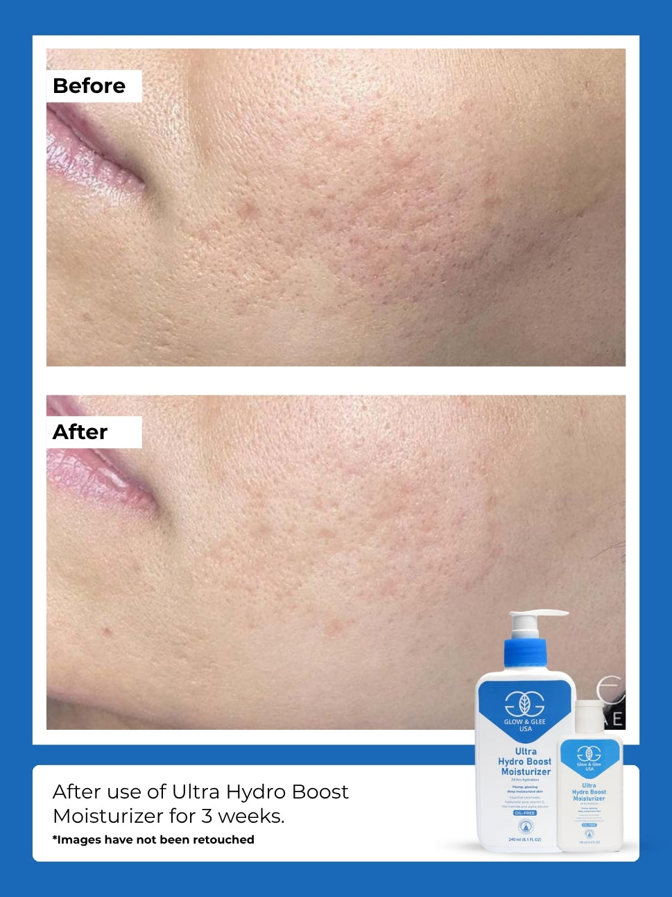 Ultra Hydro Boost  Moisturizer 24-hrs hydration