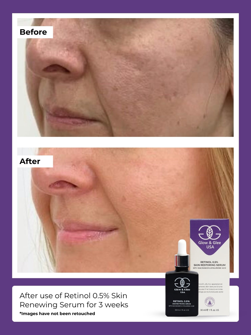 Retinol 0.5% Skin Renewing Serum 30Ml