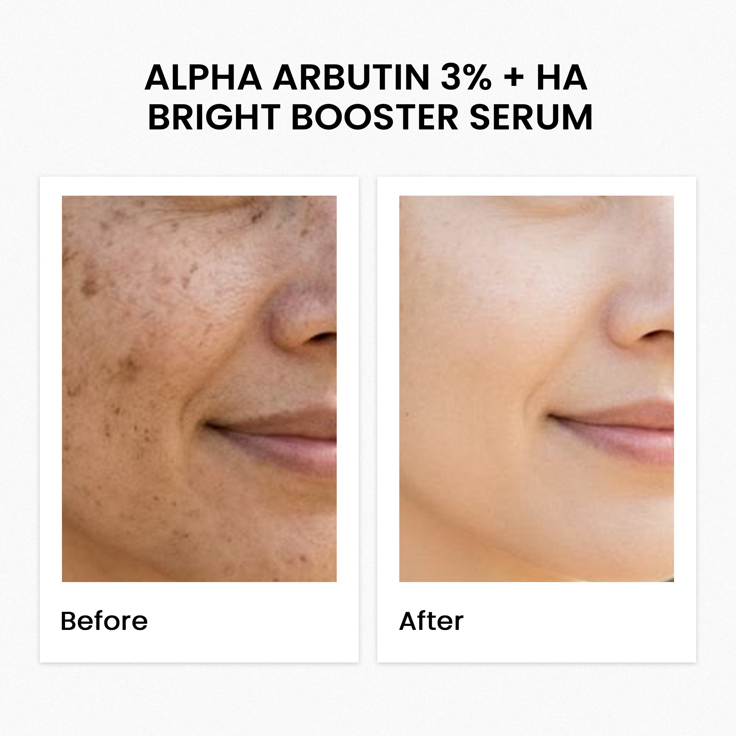Alpha Arbutin 3% + Ha Bright Booster Serum 30Ml
