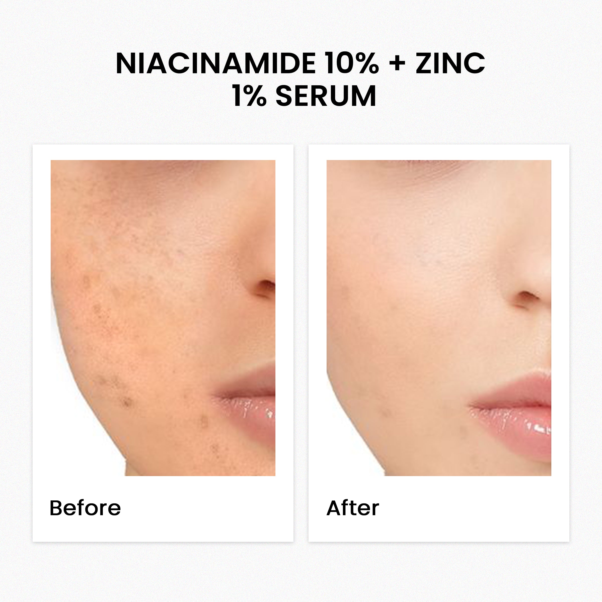 Niacinamide 10% + Zinc 1% Serum 30Ml