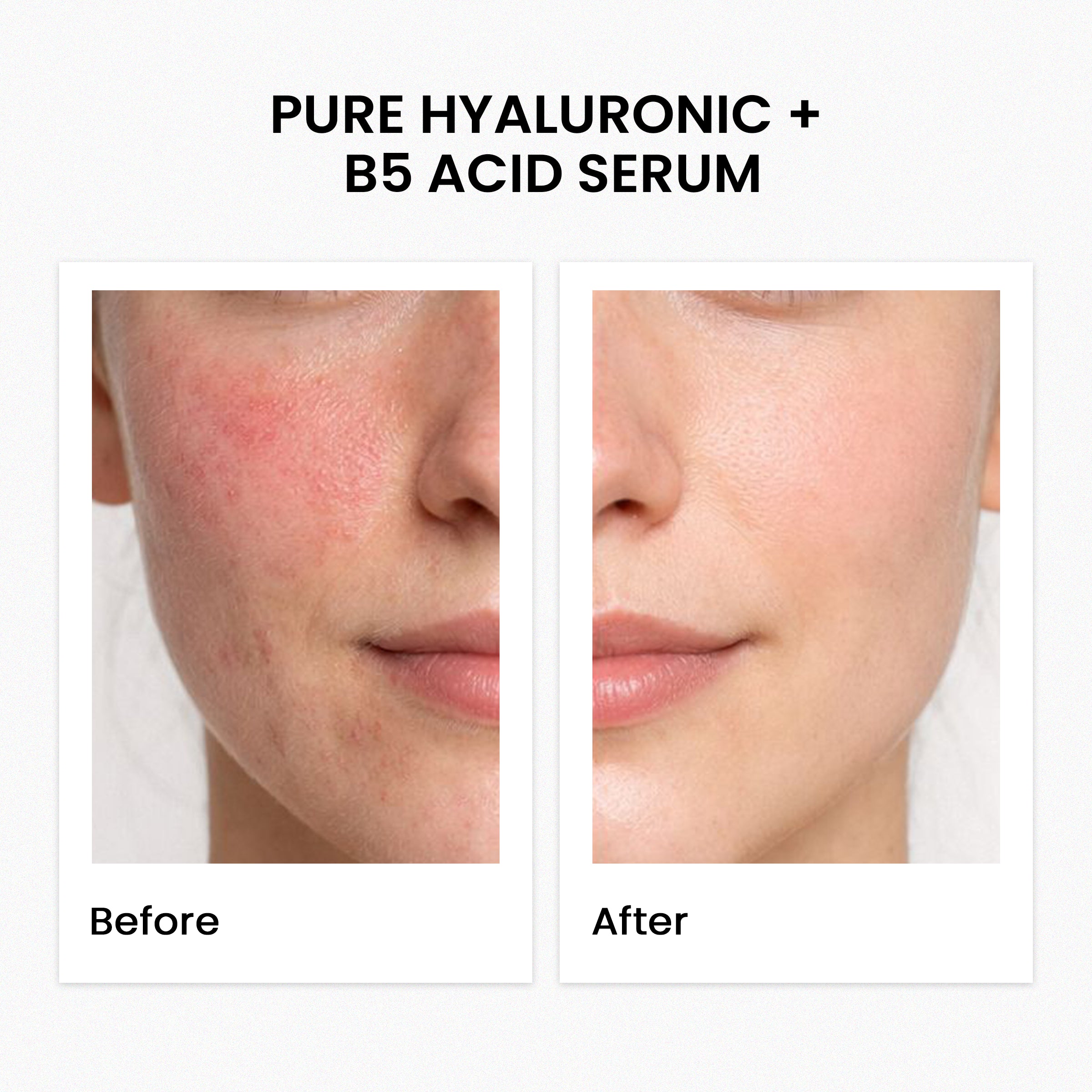 Pure Hyaluronic + B5 Acid Serum 30Ml