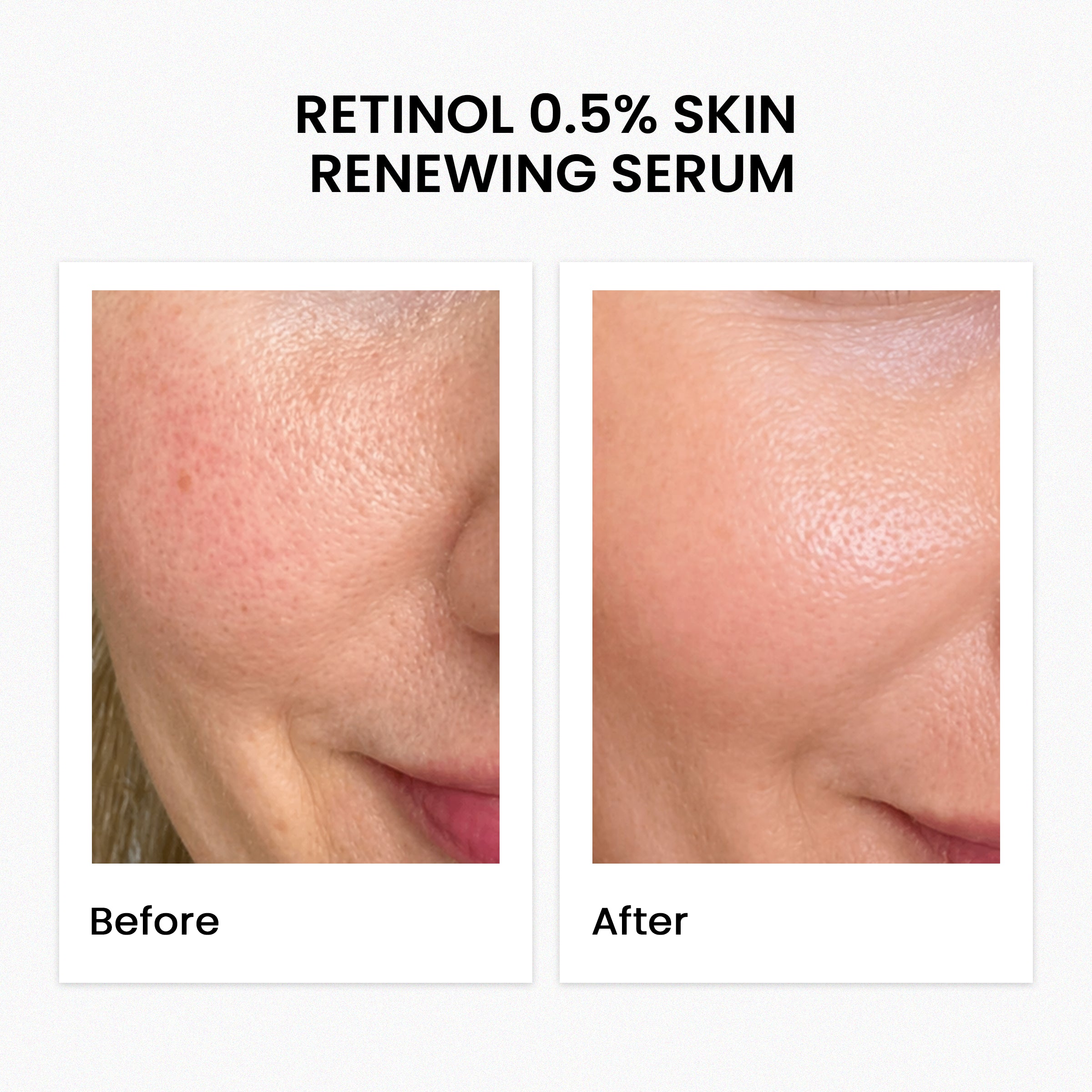 Retinol 0.5% Skin Renewing Serum 30Ml