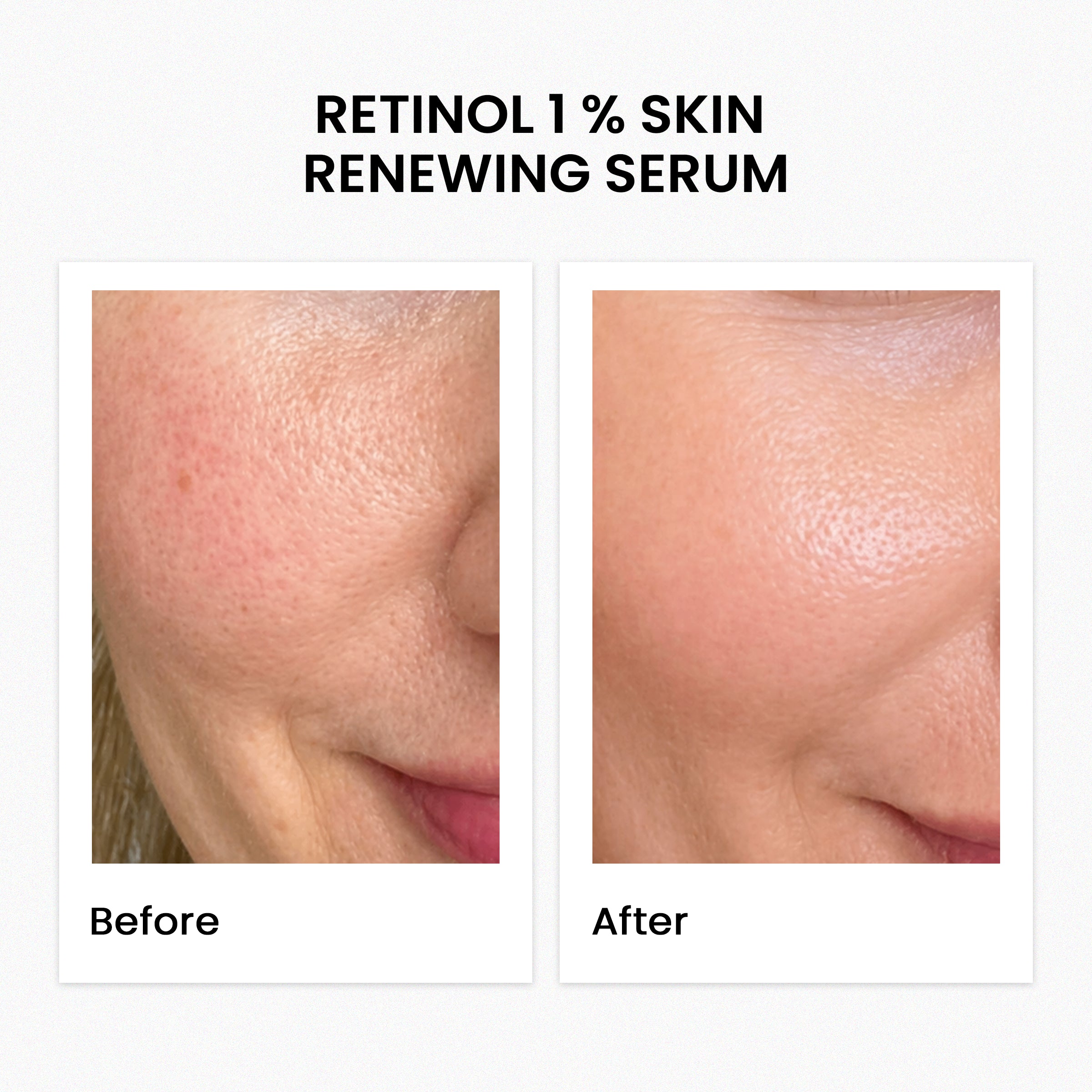 Retinol 1 % Skin Renewing Serum 30Ml