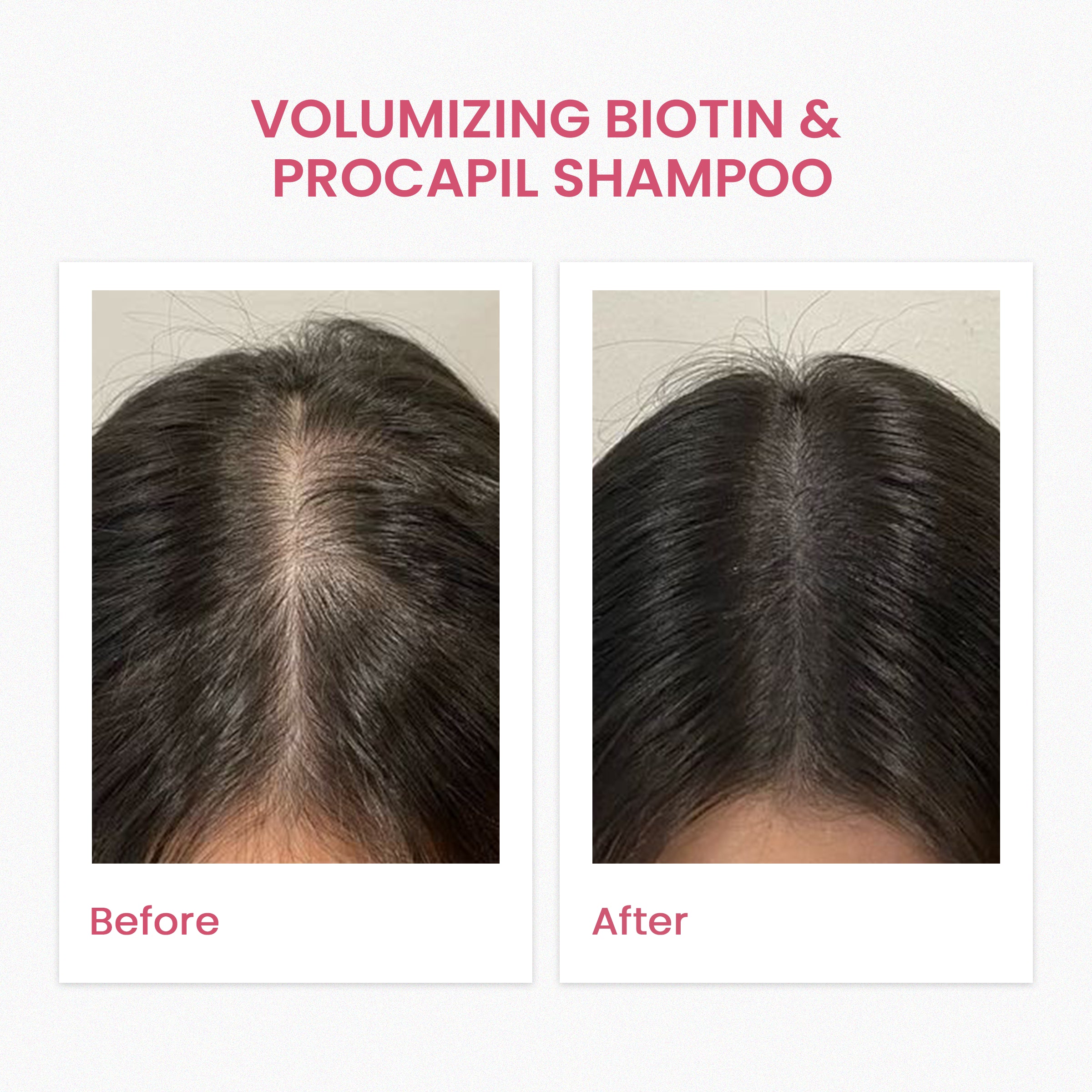 VOLUMIZING BIOTIN & PROCAPIL SHAMPOO (240ML)