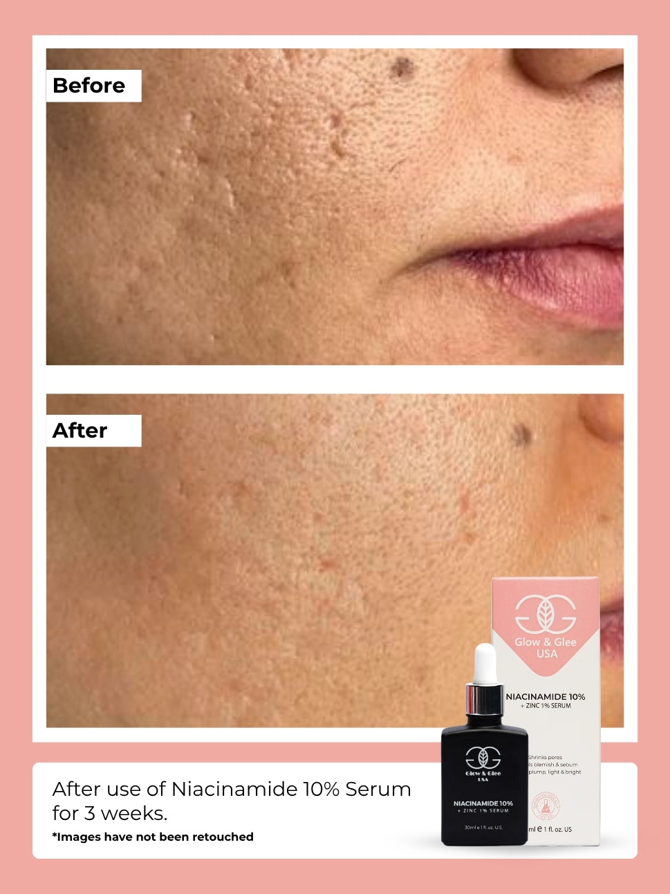 Niacinamide 10% + Zinc 1% Serum 30Ml