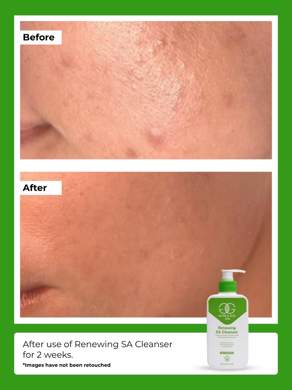 Renewing SA Cleanser For Normal Skin