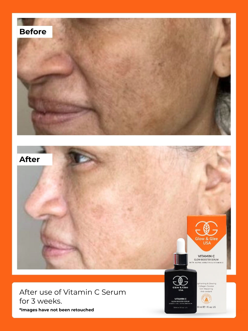 Vitamin C Glow Booster Serum 30Ml