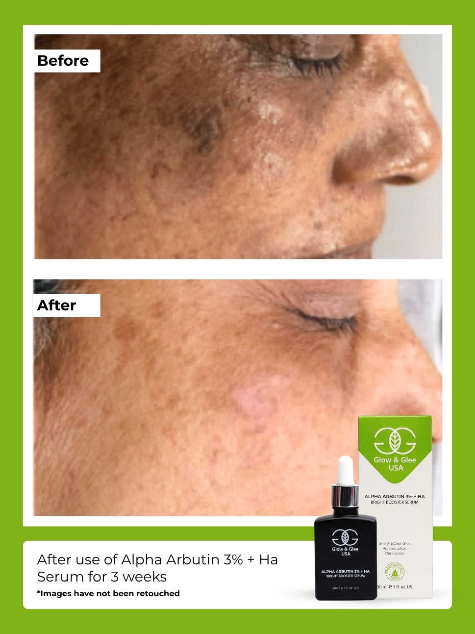 Alpha Arbutin 3% + Ha Bright Booster Serum 30Ml