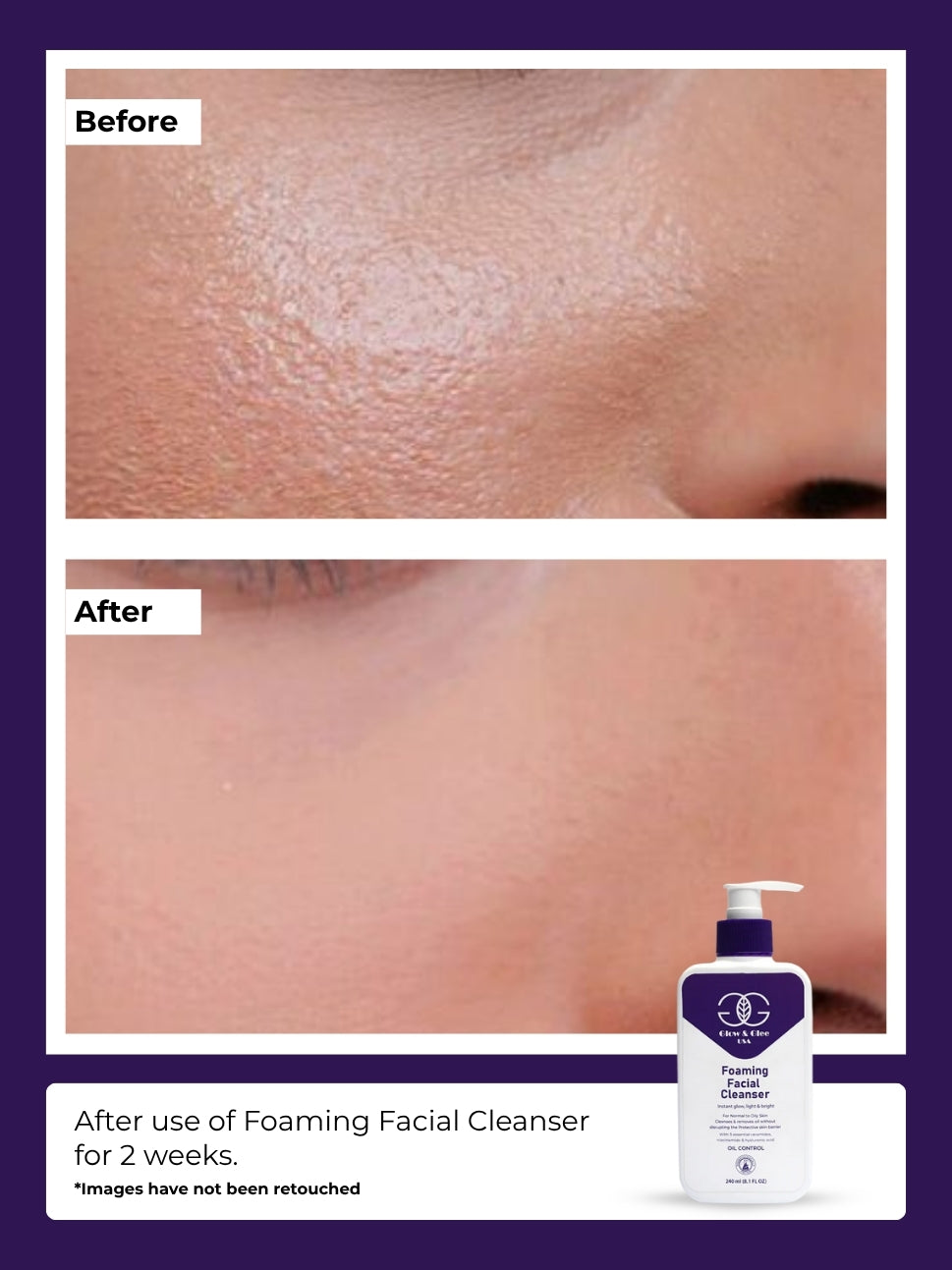 Foaming Facial Cleanser For Normal To Oily Skin