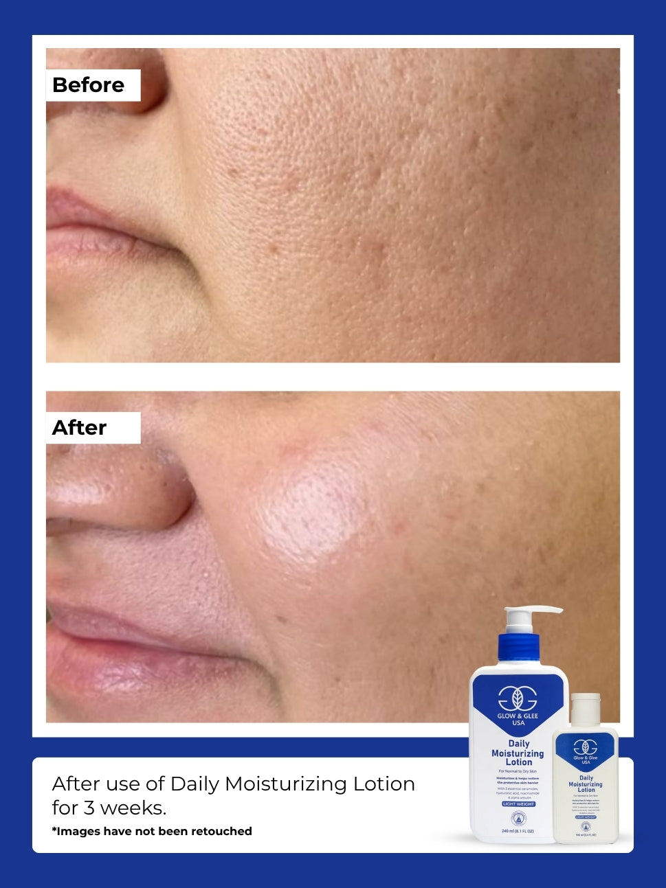 Glow & Glee Daily Moisturizing Lotion