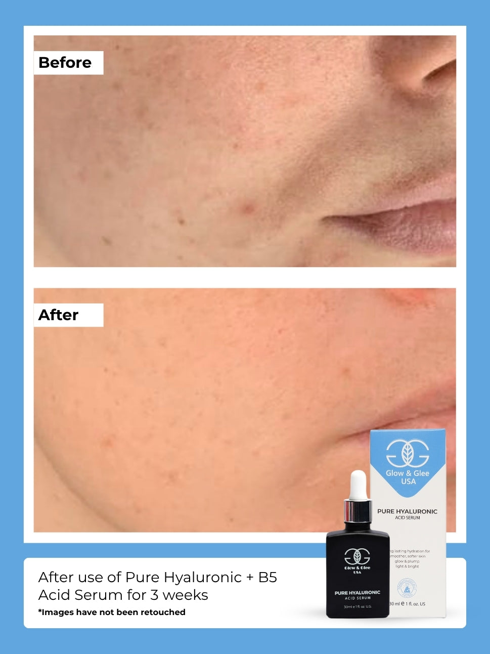 Pure Hyaluronic + B5 Acid Serum 30Ml
