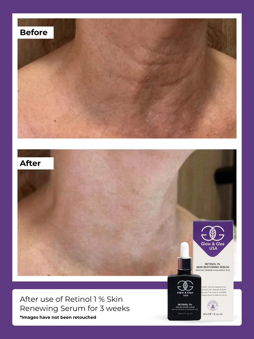Retinol 1 % Skin Renewing Serum 30Ml