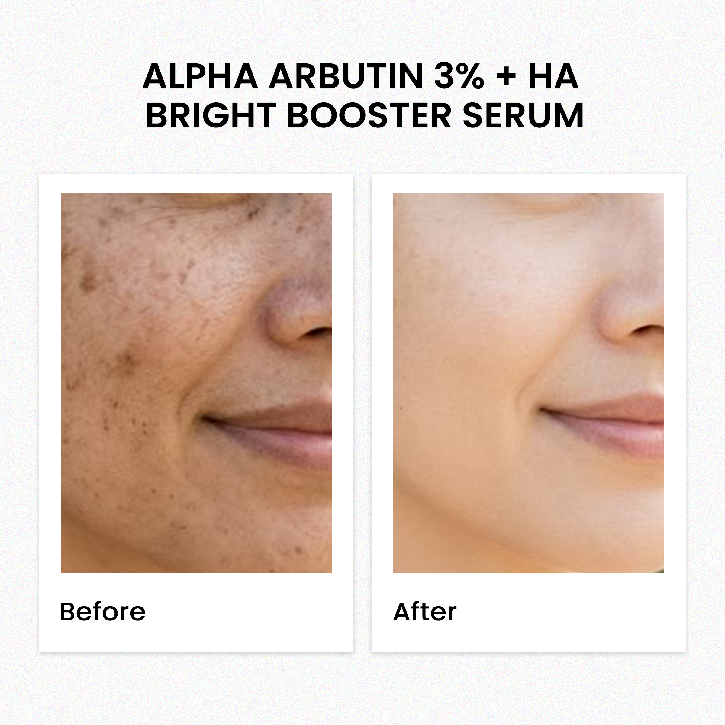 Alpha Arbutin 3% + Ha Bright Booster Serum 30Ml