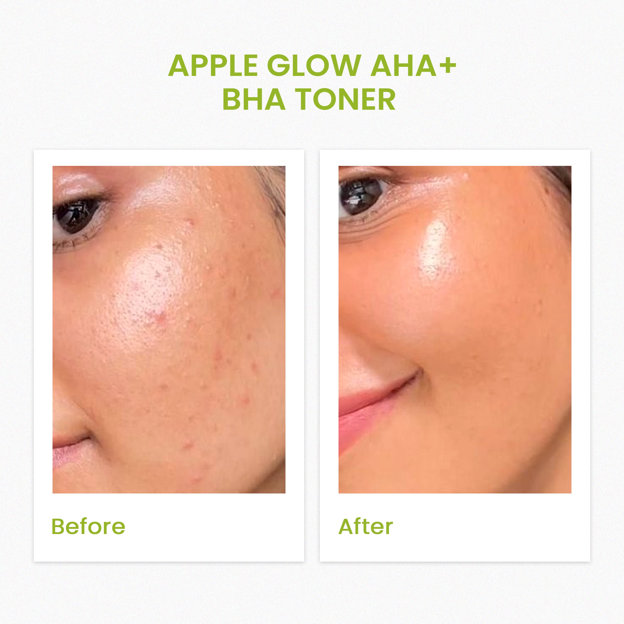 Apple Glow AHA+BHA Toner (120ML)