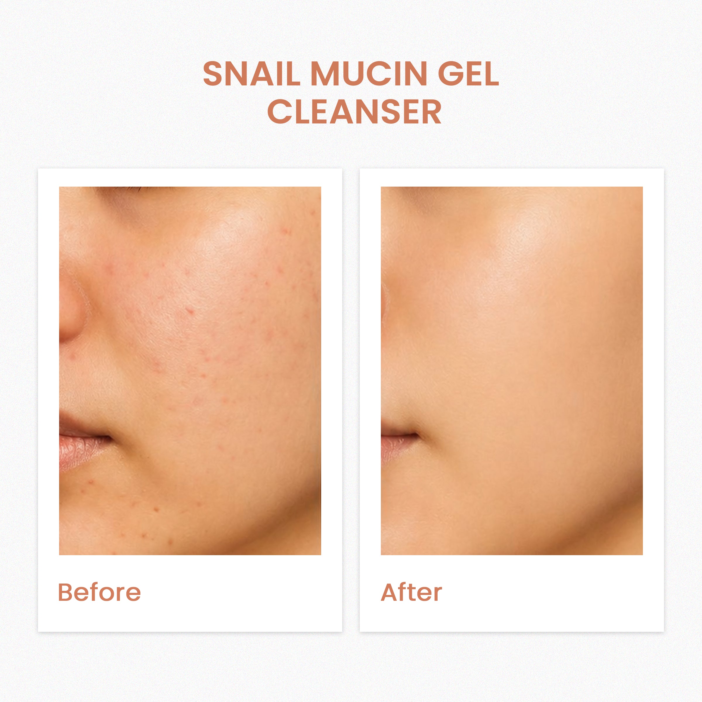 Snail Mucin Gel Cleanser For Normal To Sensitive Skin