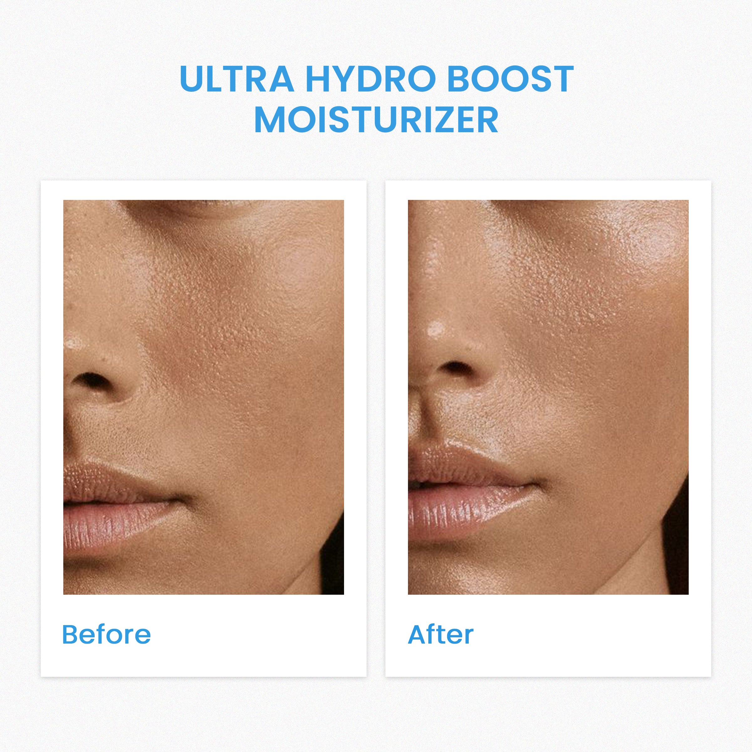 Ultra Hydro Boost  Moisturizer 24-hrs hydration